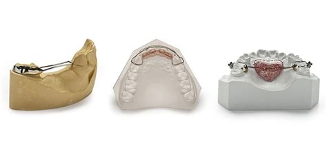 Trajtimi Ortodontik I Hershem Isufi Studio Odontoiatrico