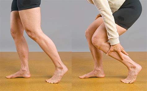 What Causes Leg Cramps Prof Dr Nurettin Lüleci