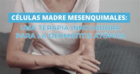 C Lulas Madre Mesenquimales Una Terapia Innovadora Para La Dermatitis