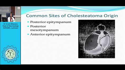 Surgery For Cholesteatoma Of The Ears Youtube