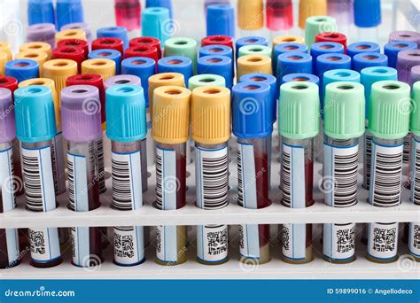 Blood Tubes In Rack In The Lab Stock Photo Image 59899016