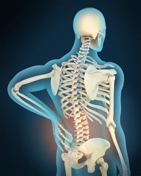Medical Illustration Showing Inflammation And Pain In Human Back Area