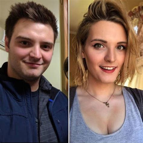 Gender Change Before And After Surgery Sex Change Operation Amazing