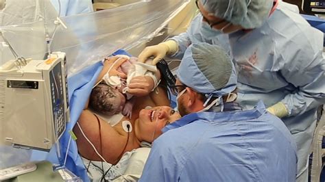Watch A C Section Delivery St Lukes Birthing Center