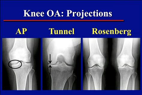 Pin On Bone And Joints