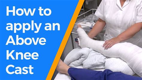How To Apply An Above Knee Cast Youtube