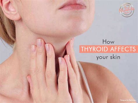 Hypothyroidism Dry Skin
