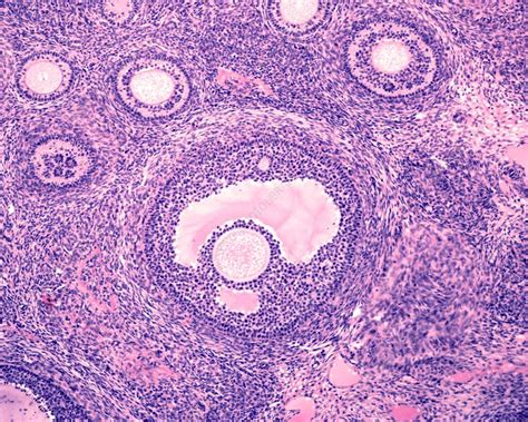 Ovarian Secondary And Tertiary Follicles Light Micrograph Stock