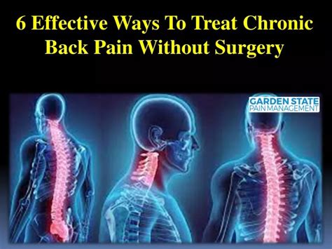 Ppt 6 Effective Ways To Treat Chronic Back Pain Without Surgery