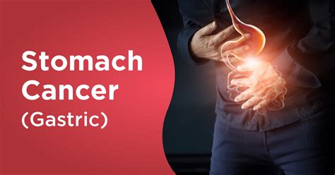 Stomach Cancer Symptoms Impressed Arena