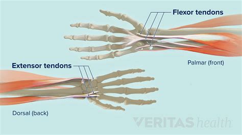 Wrist Tendonitis An Overview Sports Health