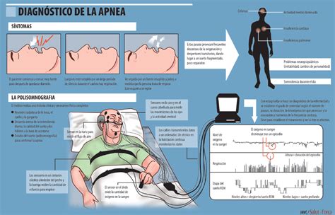 Apnea Del Sueño Ahogos En Sueños Peligro De Enfermedad Salud Ediciones