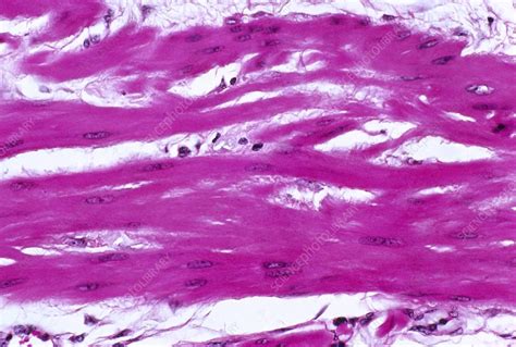 Pregnant Uterus Wall Light Micrograph Stock Image C