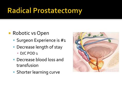 PPT Robotic Surgery In Urology PowerPoint Presentation Free Download ID