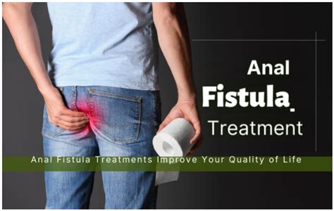 Anal Fistula Treatments Improve Your Quality Of Life