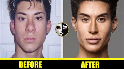Justin Jedlica Before And After Telegraph