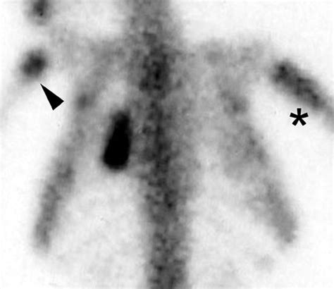 From the Archives of the AFIP | RadioGraphics