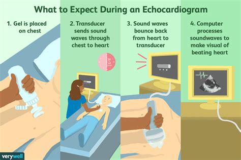 Echocardiogramme Utilisations Effets Secondaires Proc Dure R Sultats