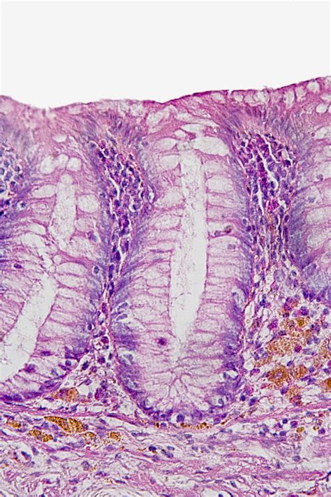 Simple Columnar Epithelium From Human Photograph By Science Stock