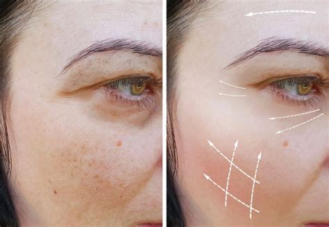Terapia Fotodinámica Facial Repara Tu Piel Cio Salud