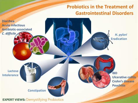 Ppt Demystifying Probiotics Role In Health And Disease Powerpoint
