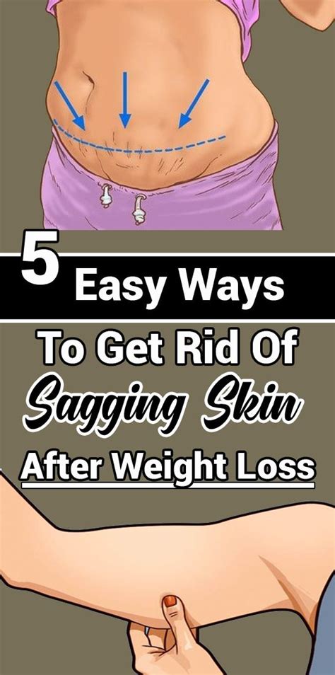 Easy Ways To Get Rid Of Sagging Skin After Weight Loss Sweet Oh Joy