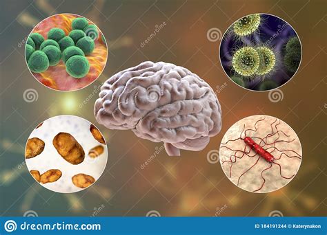 Etiology Cartoons Illustrations And Vector Stock Images 157 Pictures