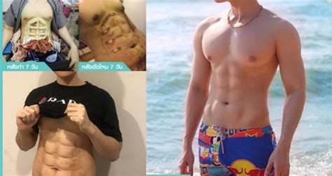 Thai Clinic Now Offers Plastic Surgery For 6 Pack Abs