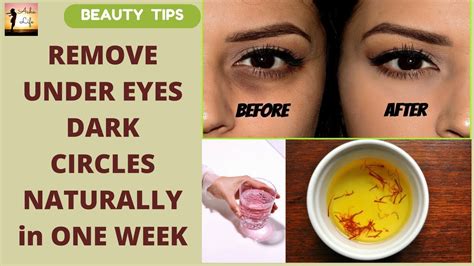 Remove Under Eyes Dark Circles Naturally In One Week Permanently