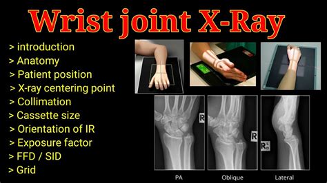 Wrist Joint X Ray Wrist Pa Lateral Oblique View Upper Limb