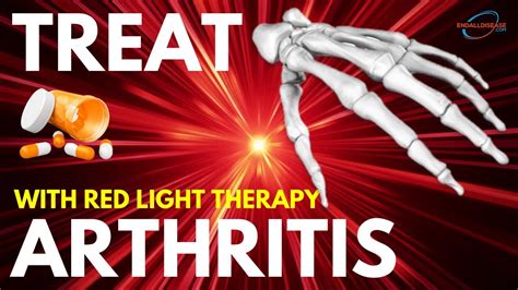 How To Treat Arthritis With Red Light Therapy Youtube