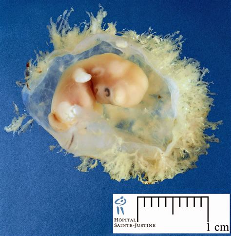 The Fetus Collection Photo Embryo At 7 Weeks