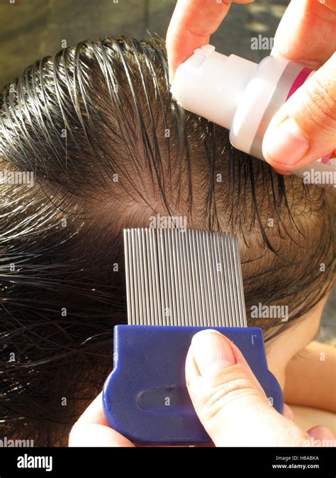 Removal Of Lice From A Childs Hair With A Lice Comb Stock Photo Alamy