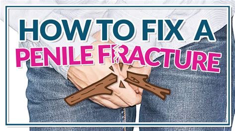 how to fix a penile fracture fairbanks urology dr tony nimeh urologist youtube