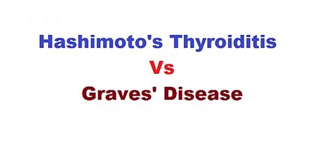 Differences Between Graves Disease And Hashimotos Thyroiditis