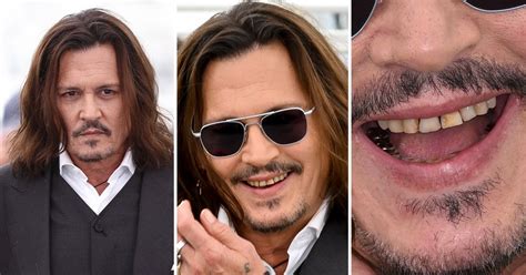 Fans Were Shocked By Johnny Depps Rotten Teeth At Cannes They