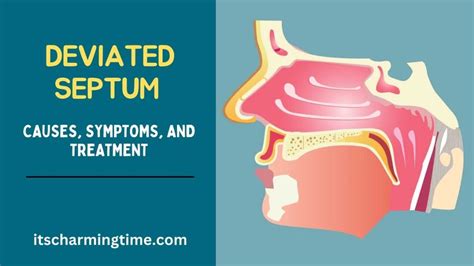 Deviated Septum Causes Symptoms And Treatment Its Charming Time