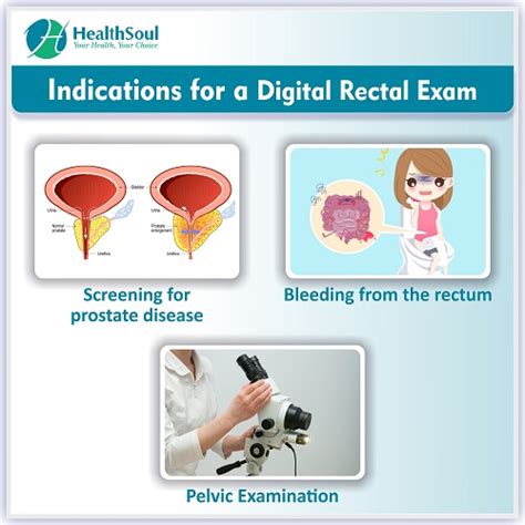 Digital Rectal Exam Indications And Procedure Healthsoul