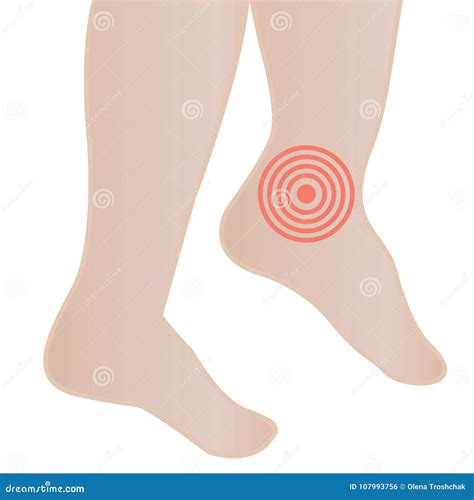 Swelling Of The Feet And Ankles From Infected Or Injury Cartoon Vector