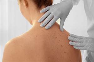 What Does Skin Cancer Look Like? - Healthcare Associates of Texas Skin Cancer  