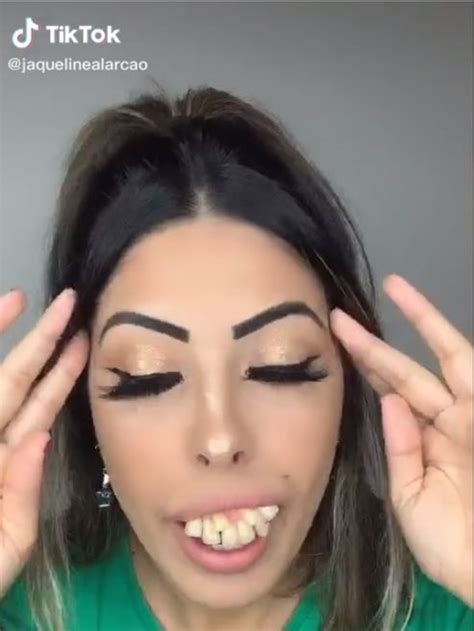 Truth About Jaqueline Alarcãos Viral Teeth Transformation In Tiktok Video Au