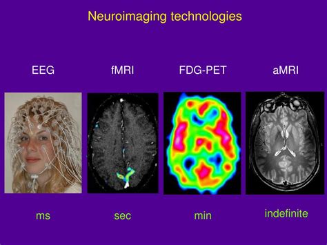 Ppt Neuroimaging Technologies Powerpoint Presentation Free Download