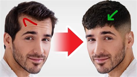 5 Hairstyles For Men With Thinning Hair That Still Look Great Real