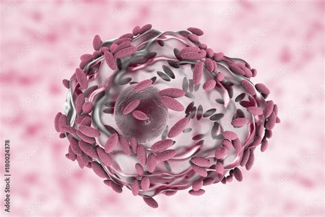 Gardnerella Vaginalis Clue Cells