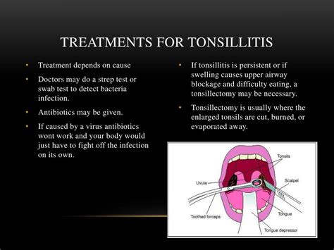 Ppt Tonsillitis And Appendicitis Powerpoint Presentation Free Download