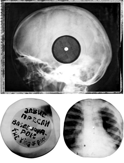 Bone Music How Banned Western Music In The Soviet Union Was Printed On