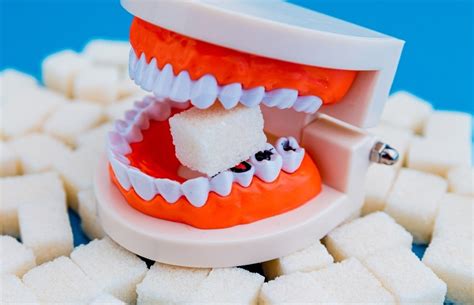 Why Sugar Is Destroying Your Teeth Maroubra Dental Avenue