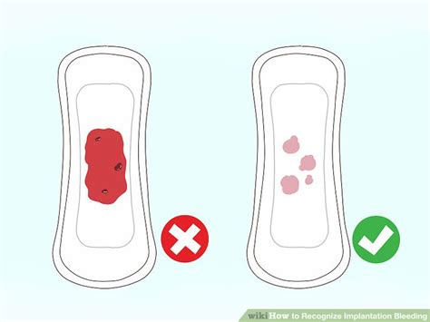 3 Ways To Recognize Implantation Bleeding Wikihow