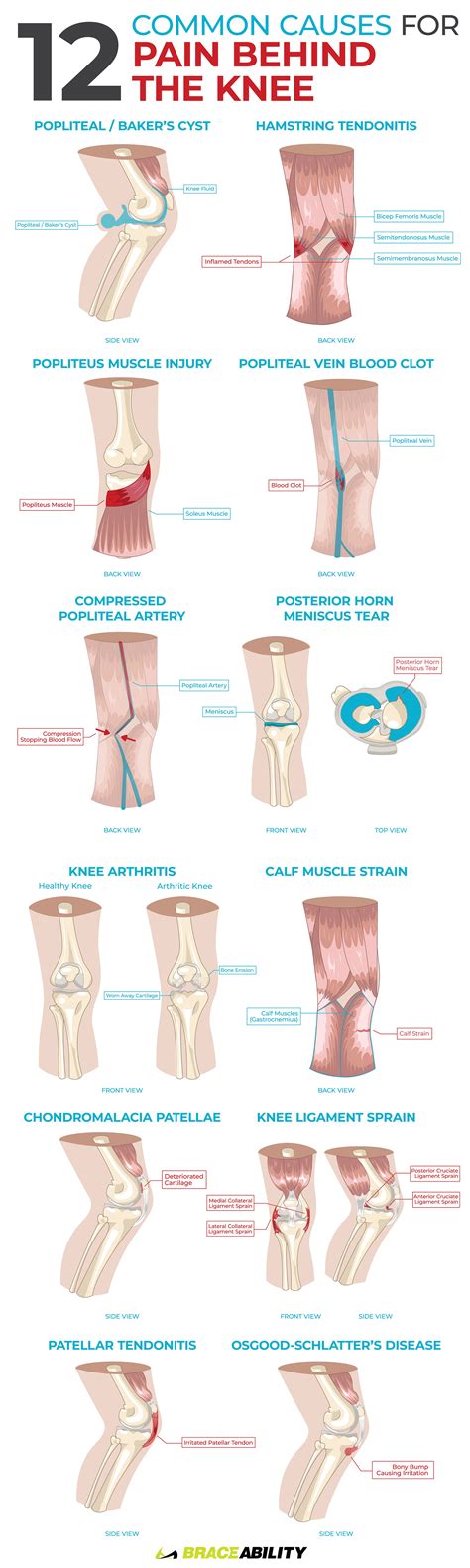 Are You Experiencing Knee Pain Do You Know Where Your Pain Is Coming From Take A Quiz To