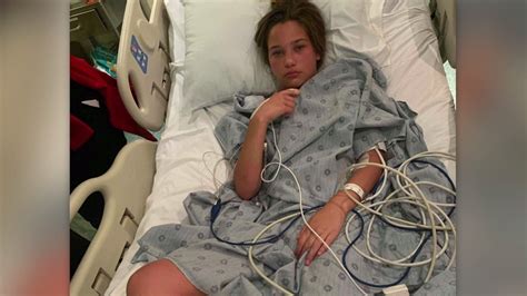 Doctors Explain How They Saved 12 Year Old After Flesh Eating Bacterial
